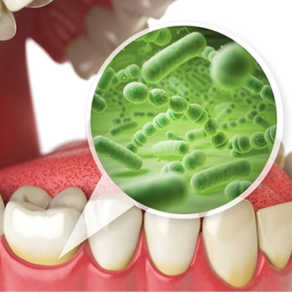 Vi khuẩn từ khoang miệng có thể xâm nhập vào cơ thể nếu không khám răng định kỳ