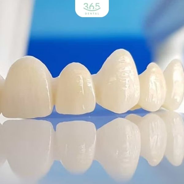 Ưu điểm của răng sứ Roland HD