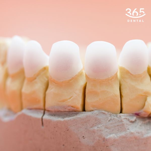 Răng sứ Katana tại Dental 365