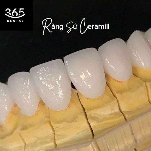 Ưu điểm của răng sứ Ceramill
